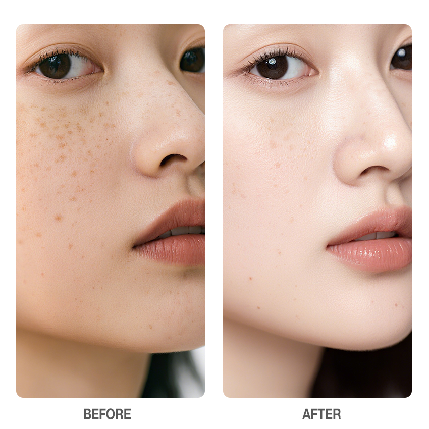 10% Niacinamide Dark Spot Care Serum-SKINEVER