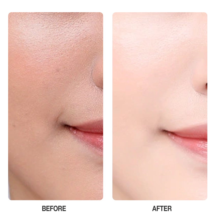 Vitamin C Brightening Cream-SKINEVER