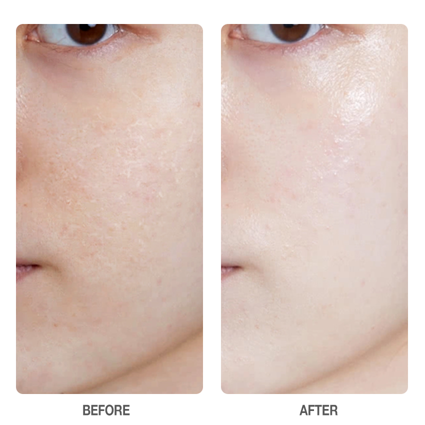 Centella Skin Soothing Toner-SKINEVER