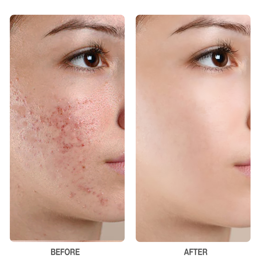 Centella Skin Soothing Toner - Travel Size-SKINEVER