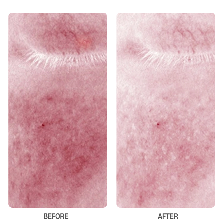 Centella Skin Soothing Serum-SKINEVER