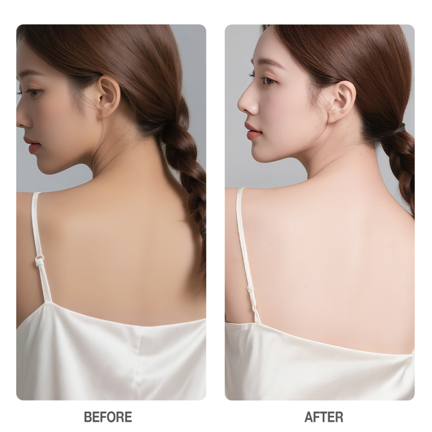 Niacinamide Skin Brightening Soap-SKINEVER