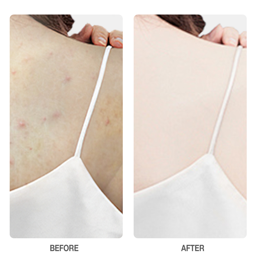 Salicylic Acid Weightless Exfoliating Body Lotion
