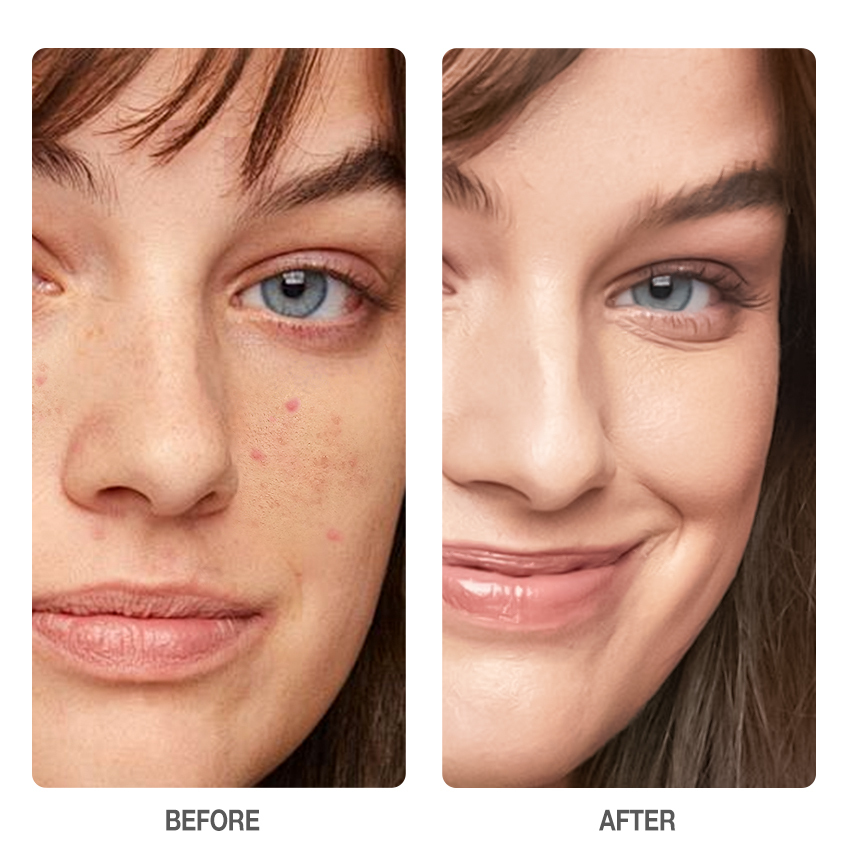 Glycolic Acid Deep Peeling Solution