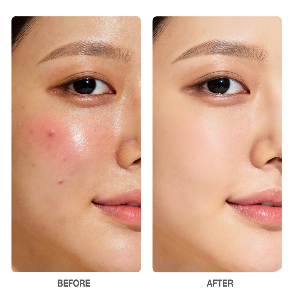 Salicylic Acid Oil Control Exfoliating Toner
