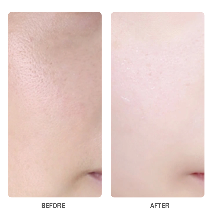 Centella Skin Soothing Cream-SKINEVER