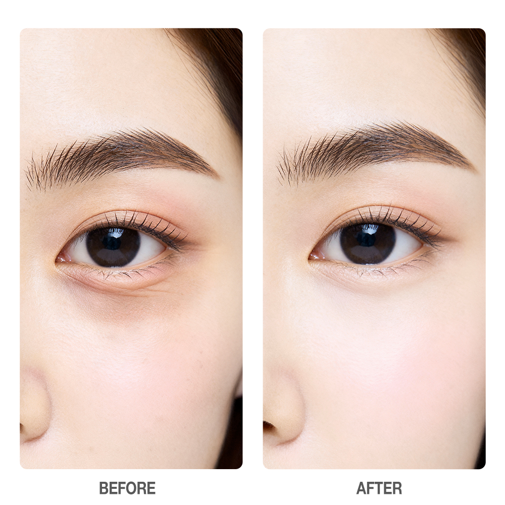 5X Vitamin C Eye Cream-SKINEVER