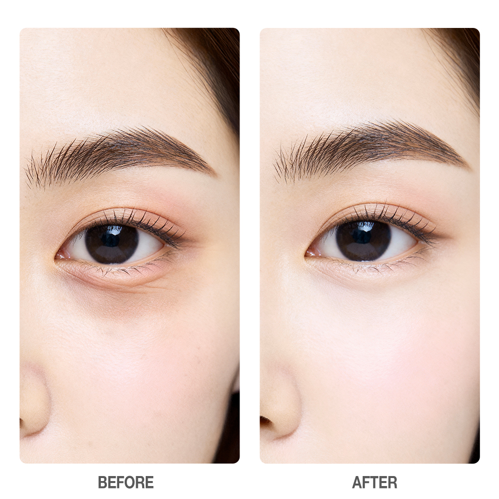 5X Vitamin C Eye Cream-SKINEVER