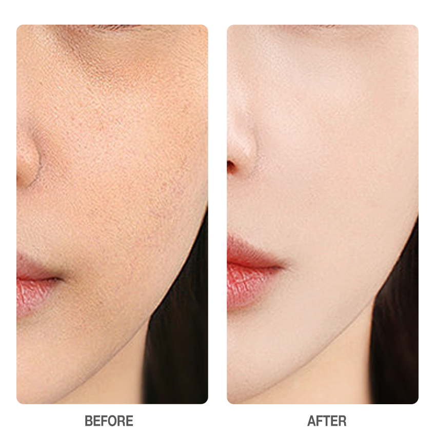 Vitamin C Brightening Skin Toner Pads-SKINEVER