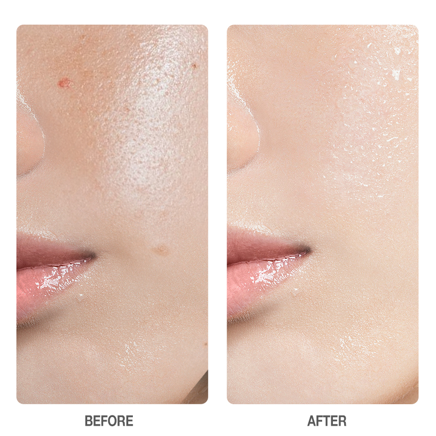 Centella Quick Calming Skin Pads-SKINEVER