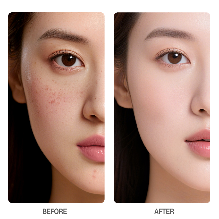 10% Niacinamide Dark Spot Care Cream-SKINEVER