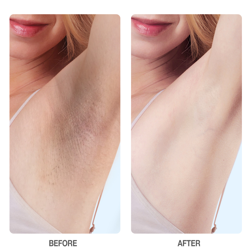 Deodorant Brightening Underarm Cream-SKINEVER