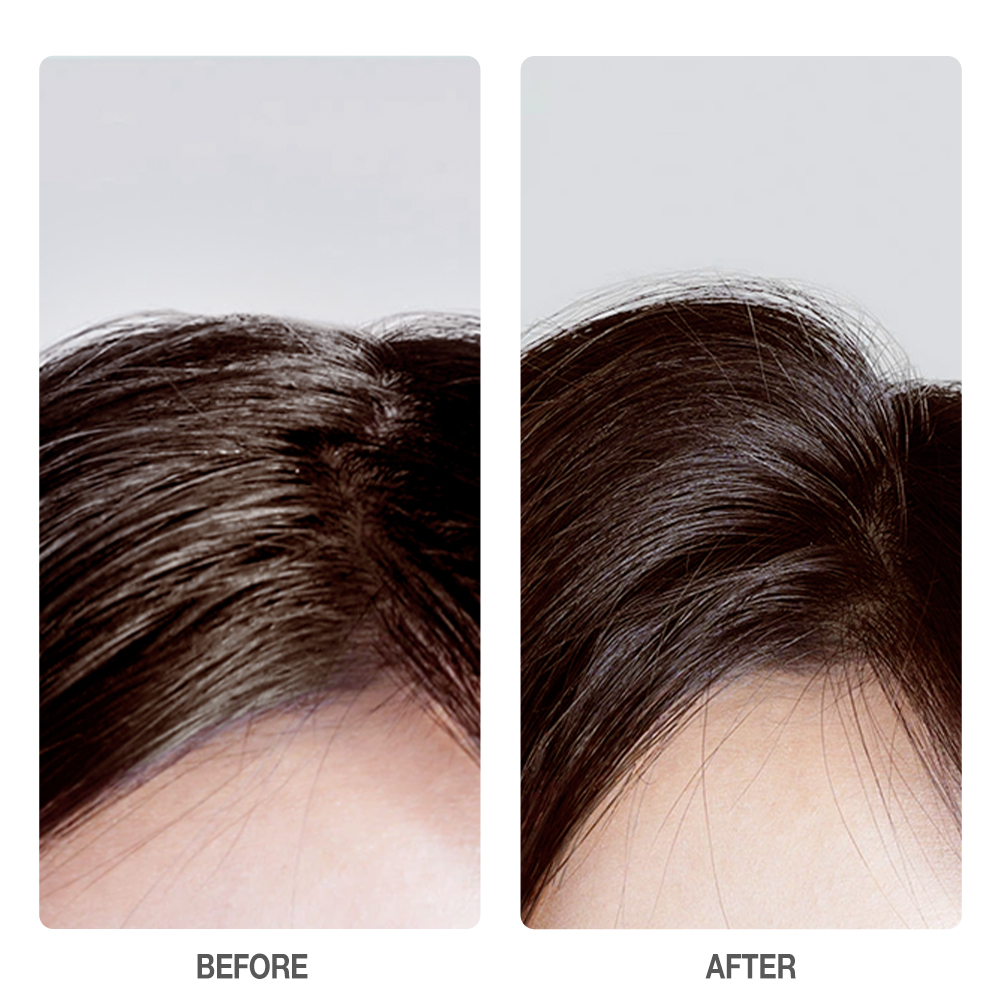 SKINEVER Amino Acid Oil Control Volumizing Shampoo volumizes and soothes the scalp with gentle care-SKINEVER