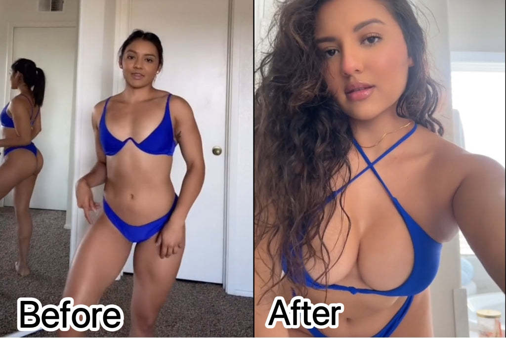 💎【Oficiální vlajkový obchod】𝐇𝐔𝐃𝐑𝐎𝐒® Náplasti s mateří kašičkou pro zvětšení prsou. Bezpečné pro použití během kojení.