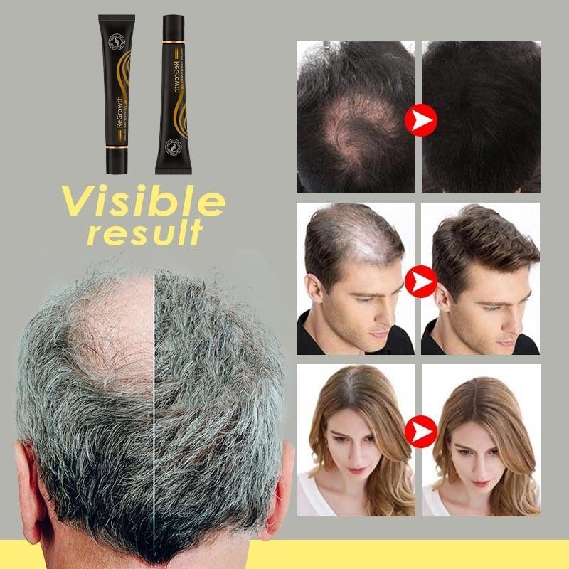 10X-Regro Organic Hair Serum Roller（Limited time discount 🔥 last day）