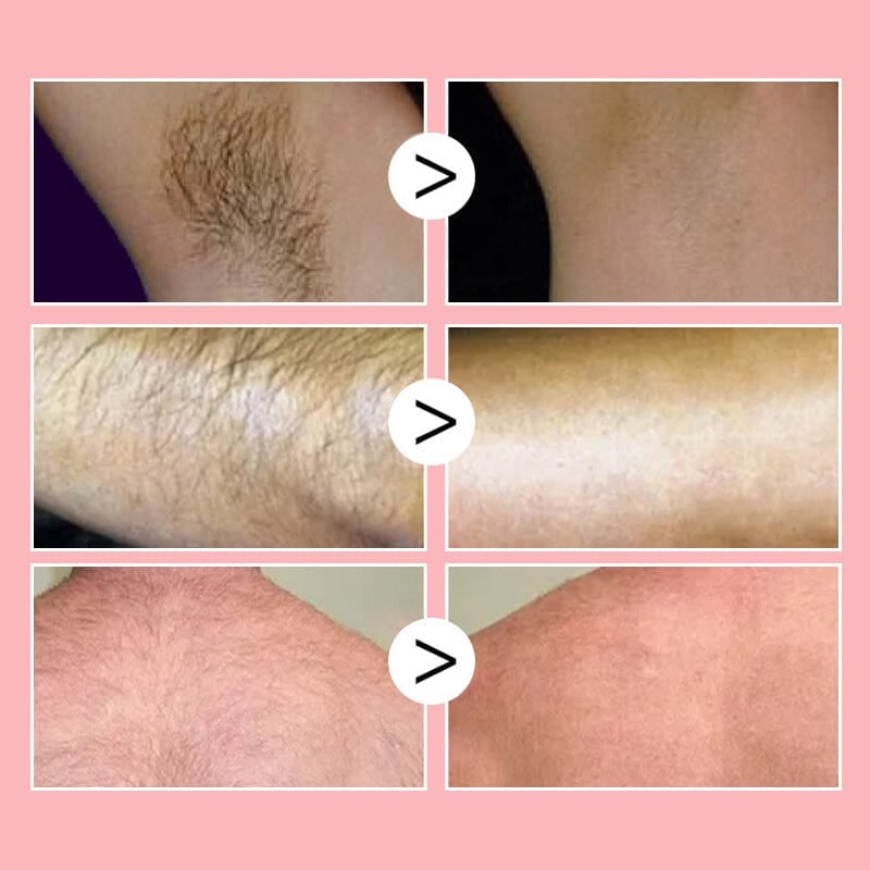 🔥Last Day SALE OFF 60%🔥 EELHOE Beeswax Hair Removal Mousse