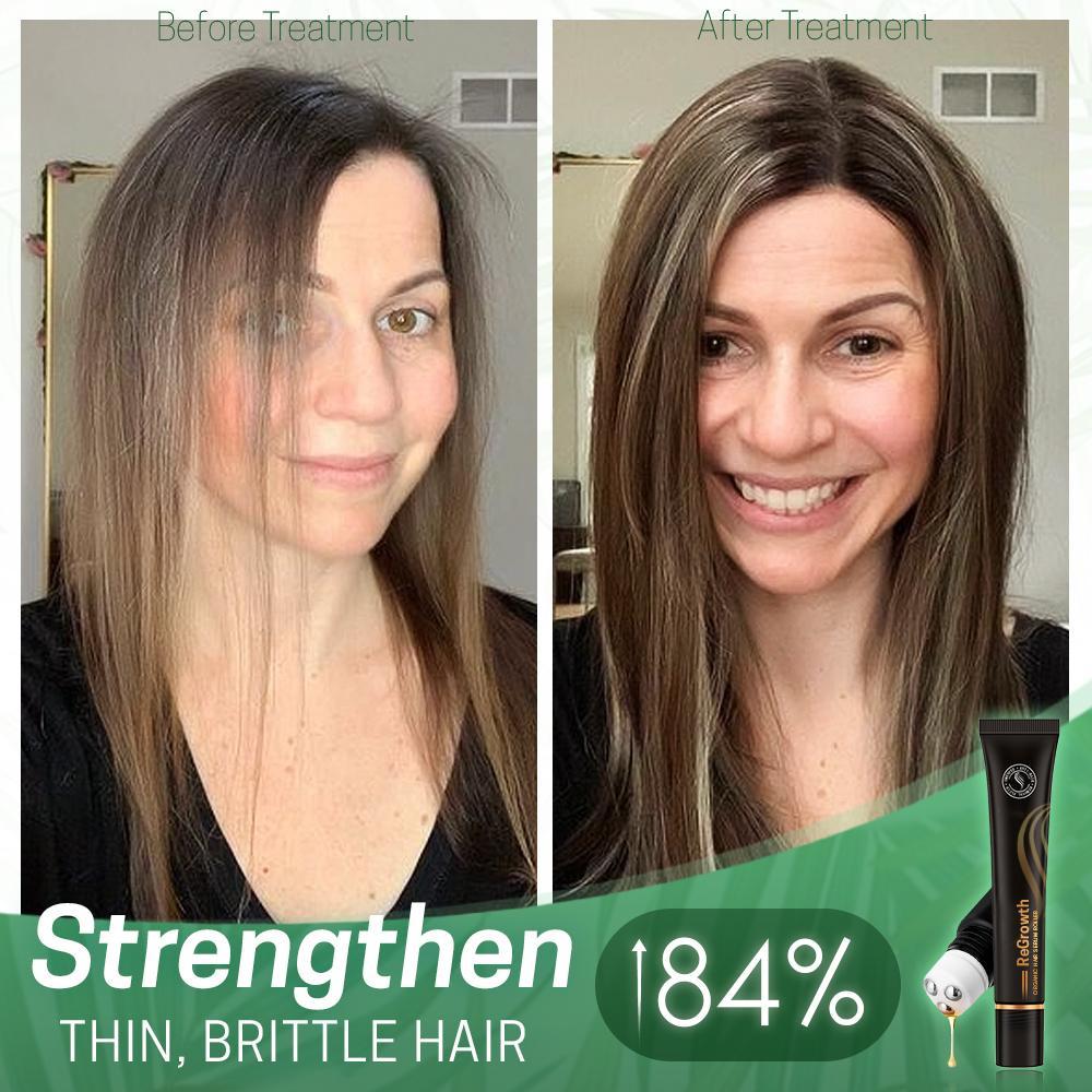 10X-Regro Organic Hair Serum Roller（Limited time discount 🔥 last day）