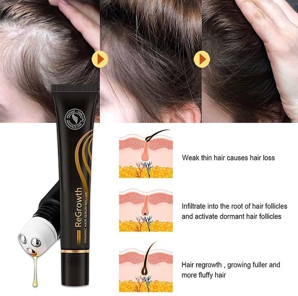 10X-Regro Organic Hair Serum Roller（Limited time discount 🔥 last day）