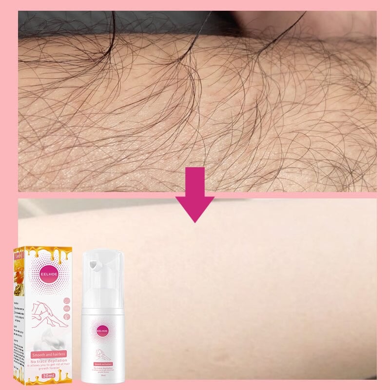 🔥Last Day SALE OFF 60%🔥 EELHOE Beeswax Hair Removal Mousse