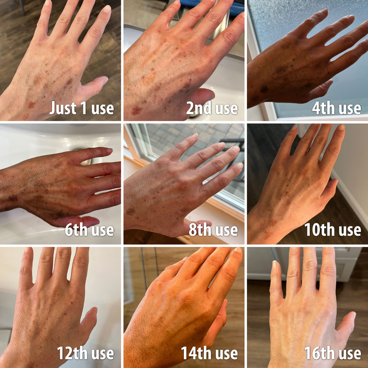 （🔥LAST DAY SALE-80% OFF)Fast Dark Spot Remover-Melanin Correcting Facial Serum