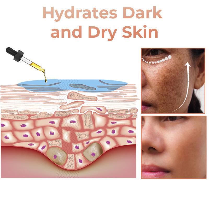 （🔥LAST DAY SALE-80% OFF)Fast Dark Spot Remover-Melanin Correcting Facial Serum