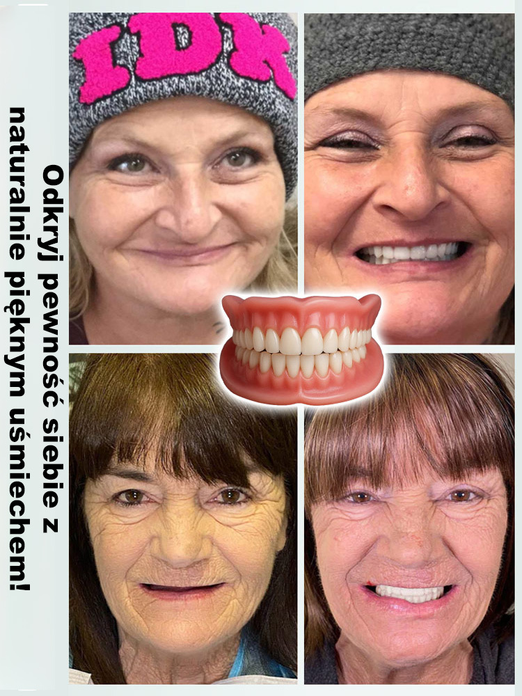 【Certyfikat FDA】 Uzupełnienie protez na bazie całej szczęki — ponad 30 000 zadowolonych użytkowników na świecie