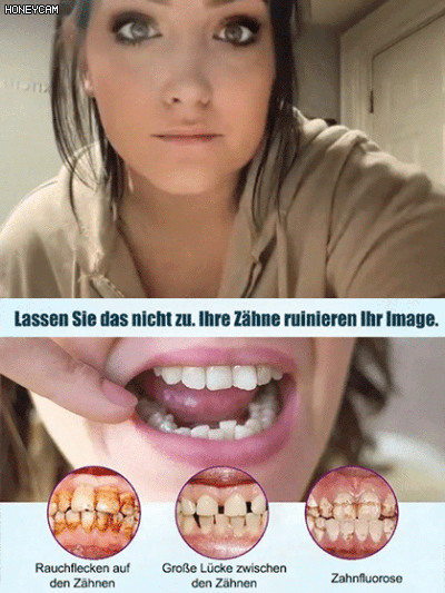 【Certyfikat FDA】 Uzupełnienie protez na bazie całej szczęki — ponad 30 000 zadowolonych użytkowników na świecie