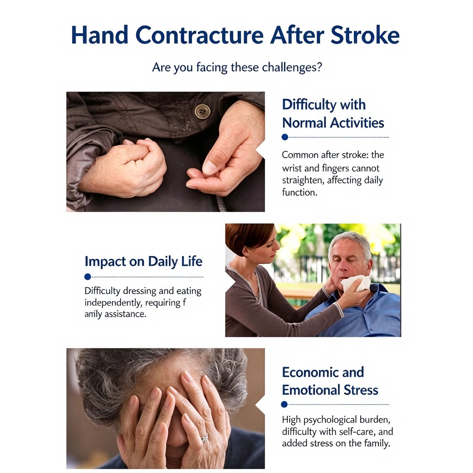 Stroke Hand Rehabilitation Splint