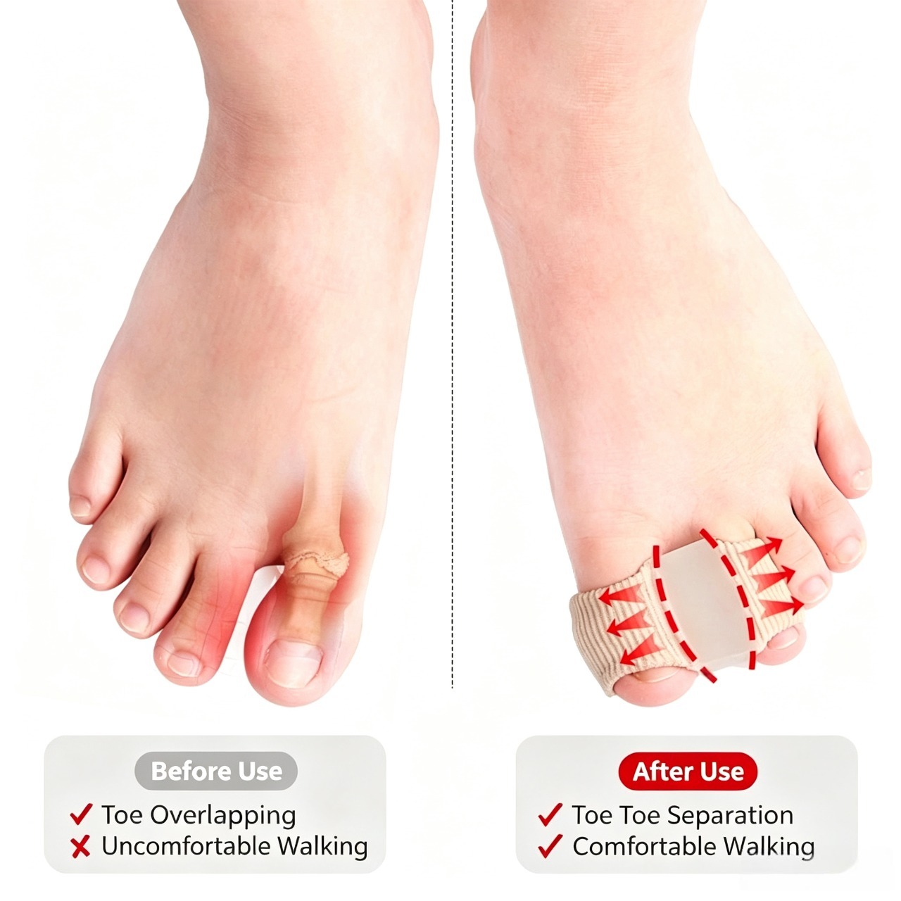 Big Toe Cushion Separator, Fibrous Toe Spacers for Men & Women Foot Care