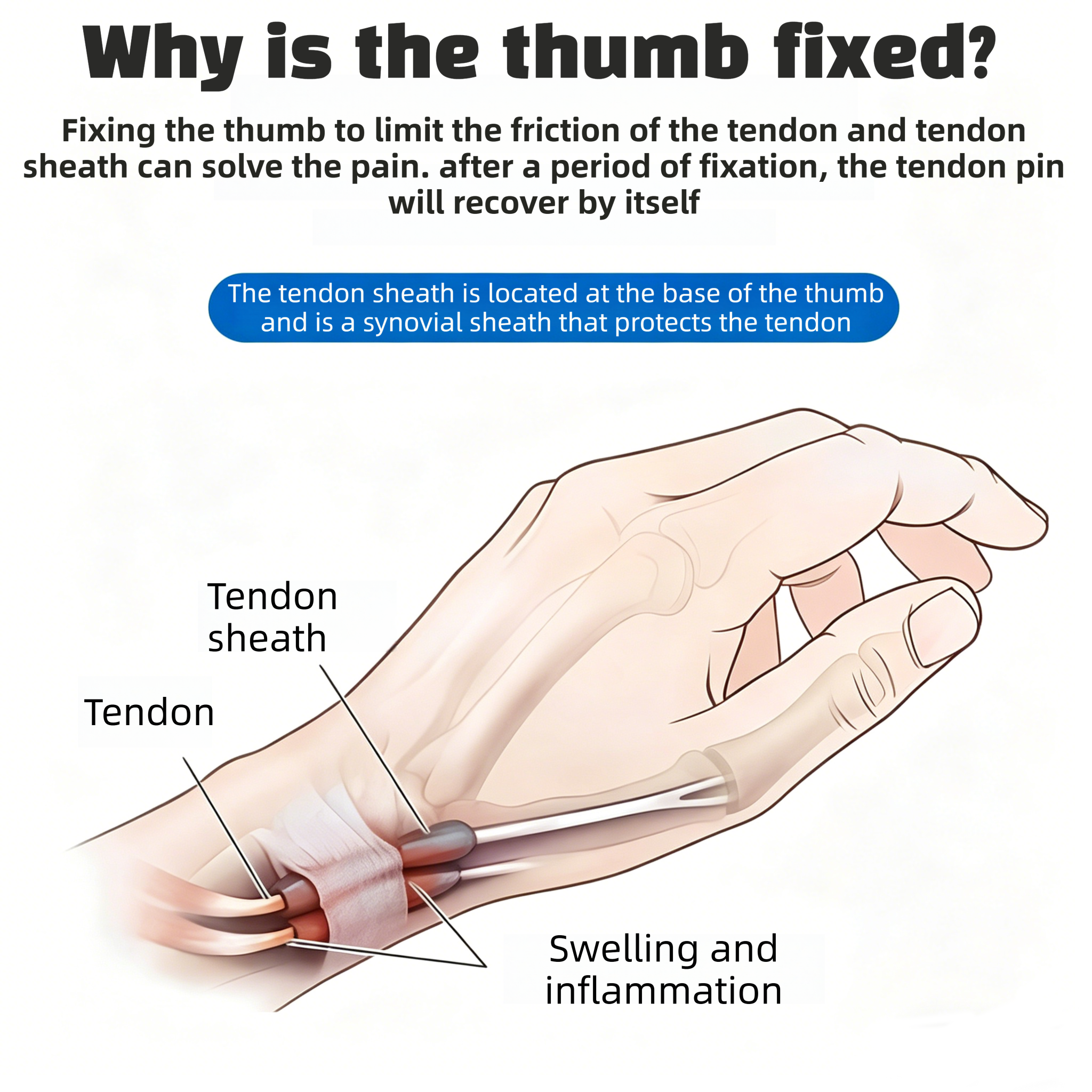 Rotating Adjustable Wrist Support Rehabilitation Brace