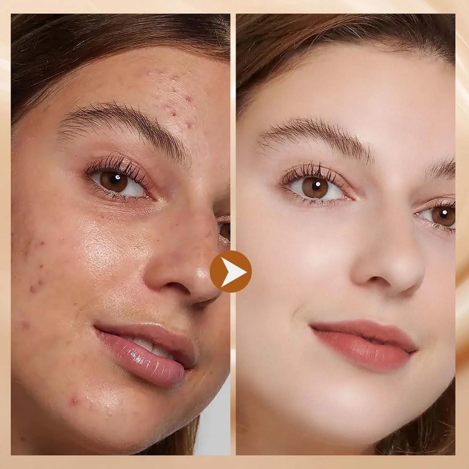 🔥BUY 1 GET 1 FREE (2 PCS)🔥 Soft Matte Cream Concealer