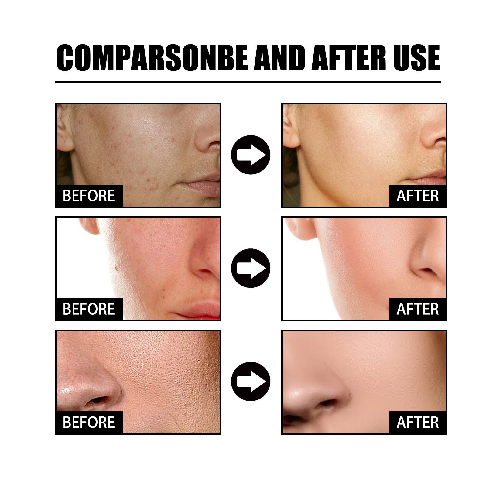 10% Niacinamide Spots Removal Serum💝Second Item half price