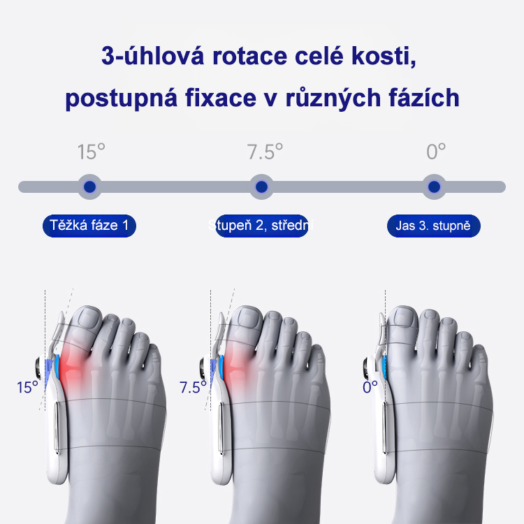 ✨Strážce zdraví palce: korektor valgózní deformace🏆