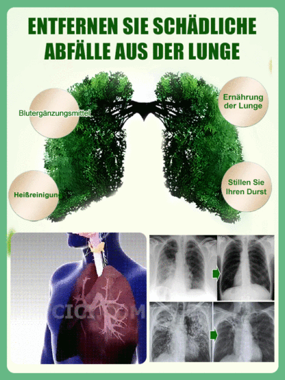 【Trockenheitsresistenter Giftkönig】Platin-Diamant-Grüne Prinzessin Topfpflanze mit großen Blättern