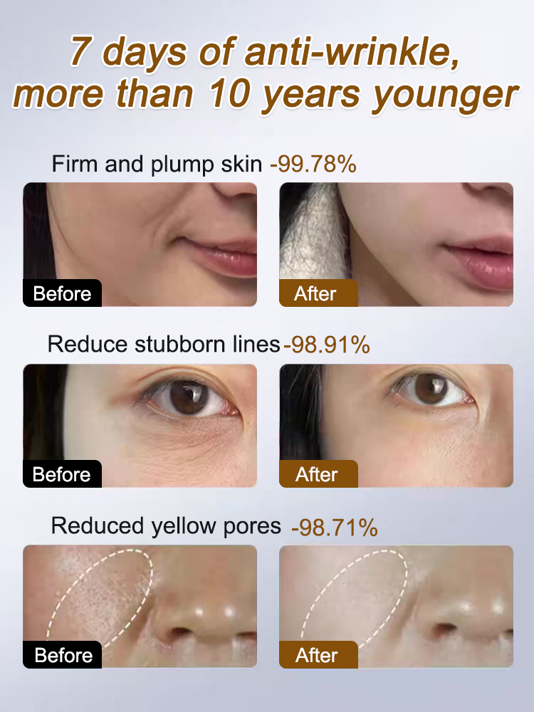 ✅✅✅【Qingyan Gold Hexapeptide Firming Essence】Contains 24K gold and 12-year-old Changbai Mountain ginseng. It reduces wrinkles in 7 days, firms by 99.78%, and reduces stubborn lines by 98.91%.