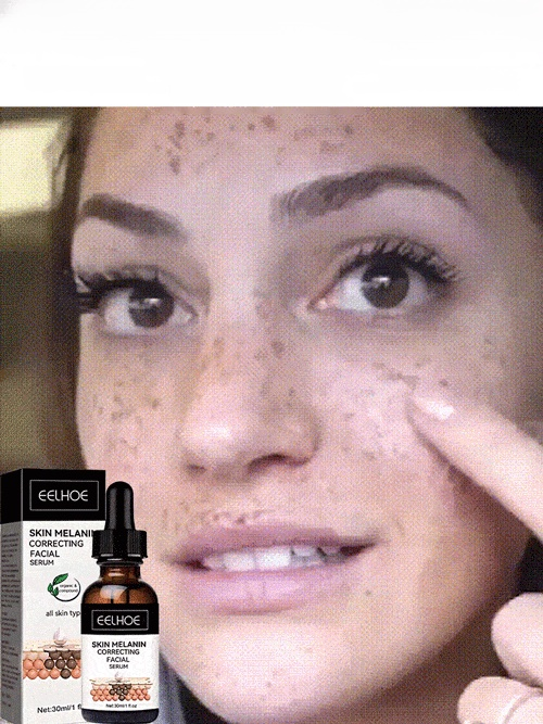 🔬Recommended by Harvard dermatologists! Fast-acting Whitening and Spot-dissolving Essence🌟 Fades sun spots/acne scars in 7 days ✅ No irritation, no rebound darkening