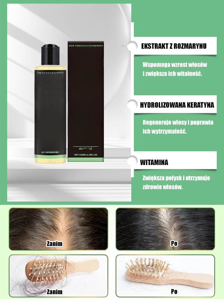 【Odżywianie przez 3 dni, wzrost włosów w 7 dni】Pełny zwrot pieniędzy, jeśli brak rezultatów.