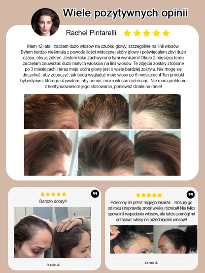 【Polecane przez lekarzy, efekty już po trzech dniach】Gorąca sprzedaż Szampon przeciw wypadaniu włosów z ekstraktem z imbiru