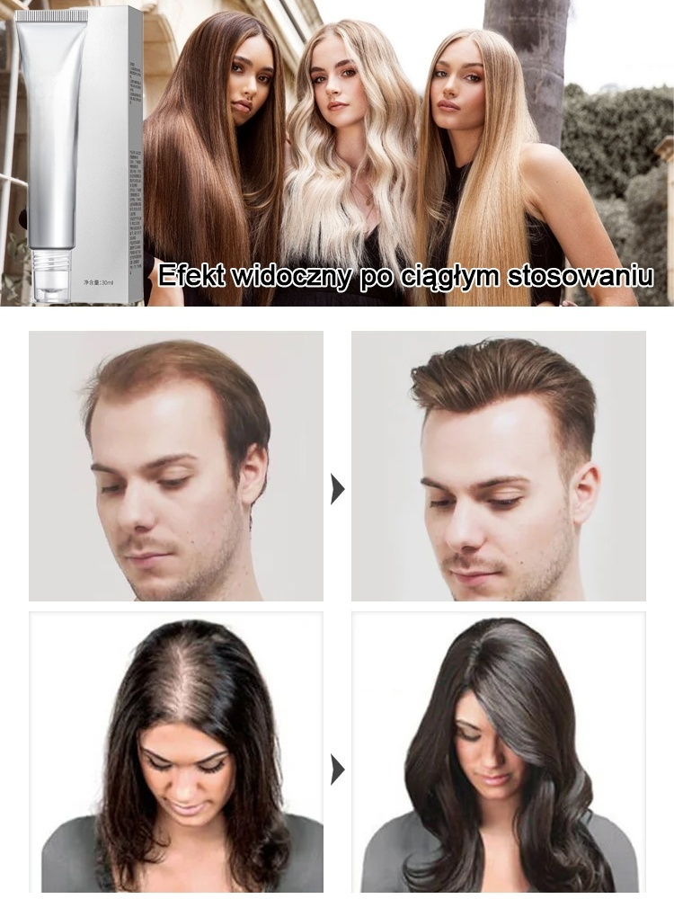 Serum w kulce wzmacniające cebulki włosów, zapobiegające wypadaniu i wspomagające porost włosów.