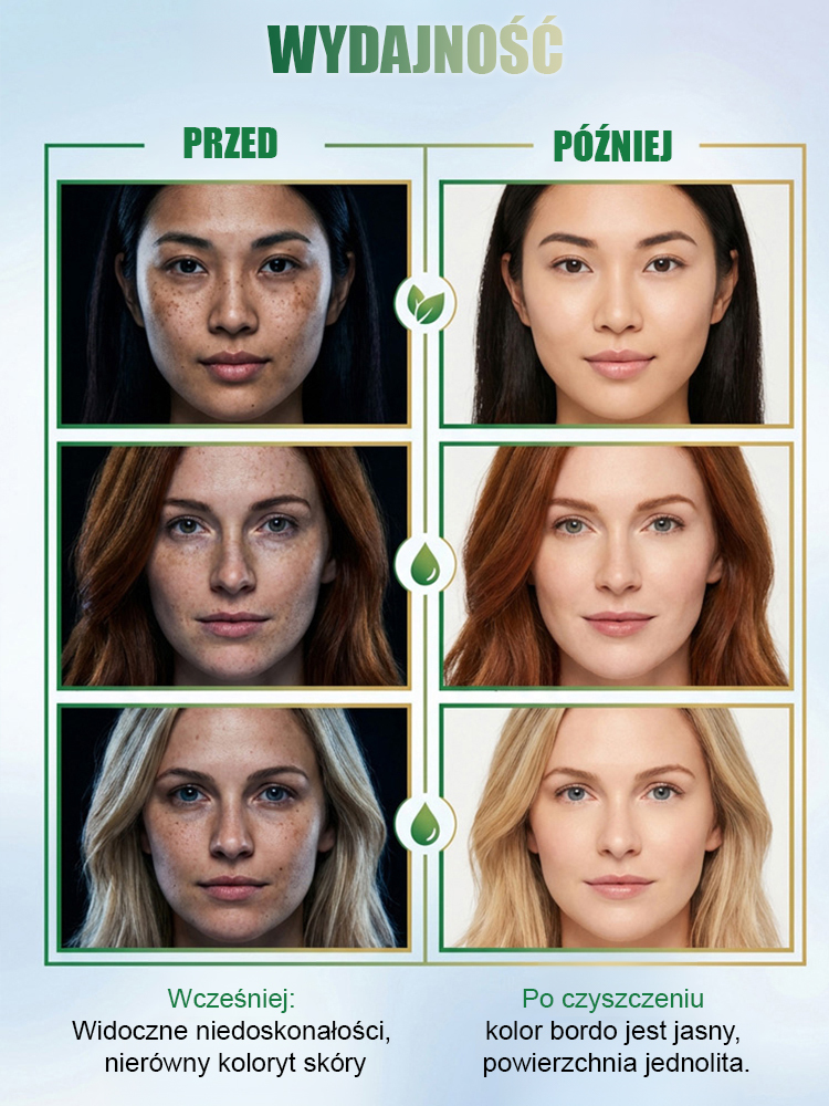 Wystarczy jeden spray! 🌟 Głęboko wnika w skórę, łatwo usuwając uporczywe plamy! 💥