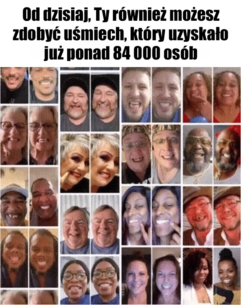 Odzyskaj swój uśmiech w 2 minuty! 🦷 Koniec z drogim dentystą!