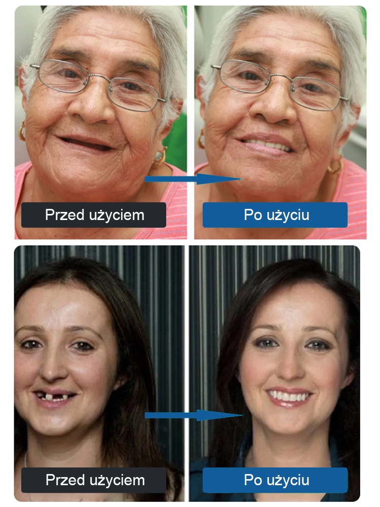 Odzyskaj swój uśmiech w 2 minuty! 🦷 Koniec z drogim dentystą!