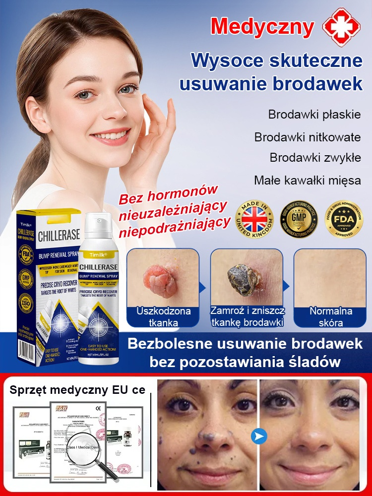 🧴 Medyczny spray do pielęgnacji brodawek! Precyzyjna krioterapia usuwa brodawki bez bólu!