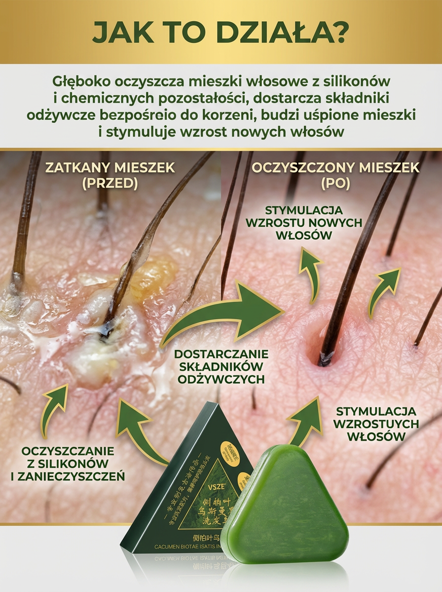 🌿Budzi martwe cebulki, w 7 dni hamuje łysienie, w 30 dni daje gęste nowe włosy!