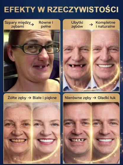 Bez kleju, bez dentysty, bez wizyty! | Tylko w 1 minutę zdobądź idealnie dopasowane sztuczne zęby z naszym przenośnym zestawem! Odzyskaj pewność uśmiechu! 🦷