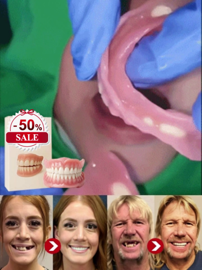 ✨Bez kleju, bez dentysty, bez wizyty! | Tylko w 1 minutę zdobądź idealnie dopasowane sztuczne zęby z naszym przenośnym zestawem! Odzyskaj pewność uśmiechu! 🦷✨