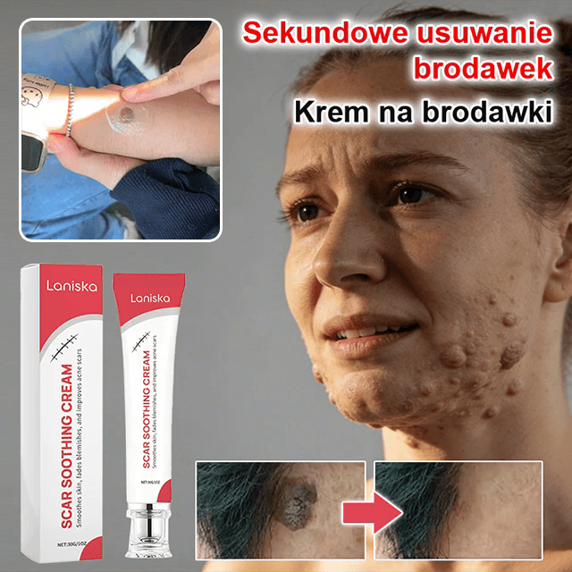 🌟Wystarczy jeden zastosować, a skóra natychmiast staje się gładka i bez śladów! Bez operacji, bez wysokich kosztów