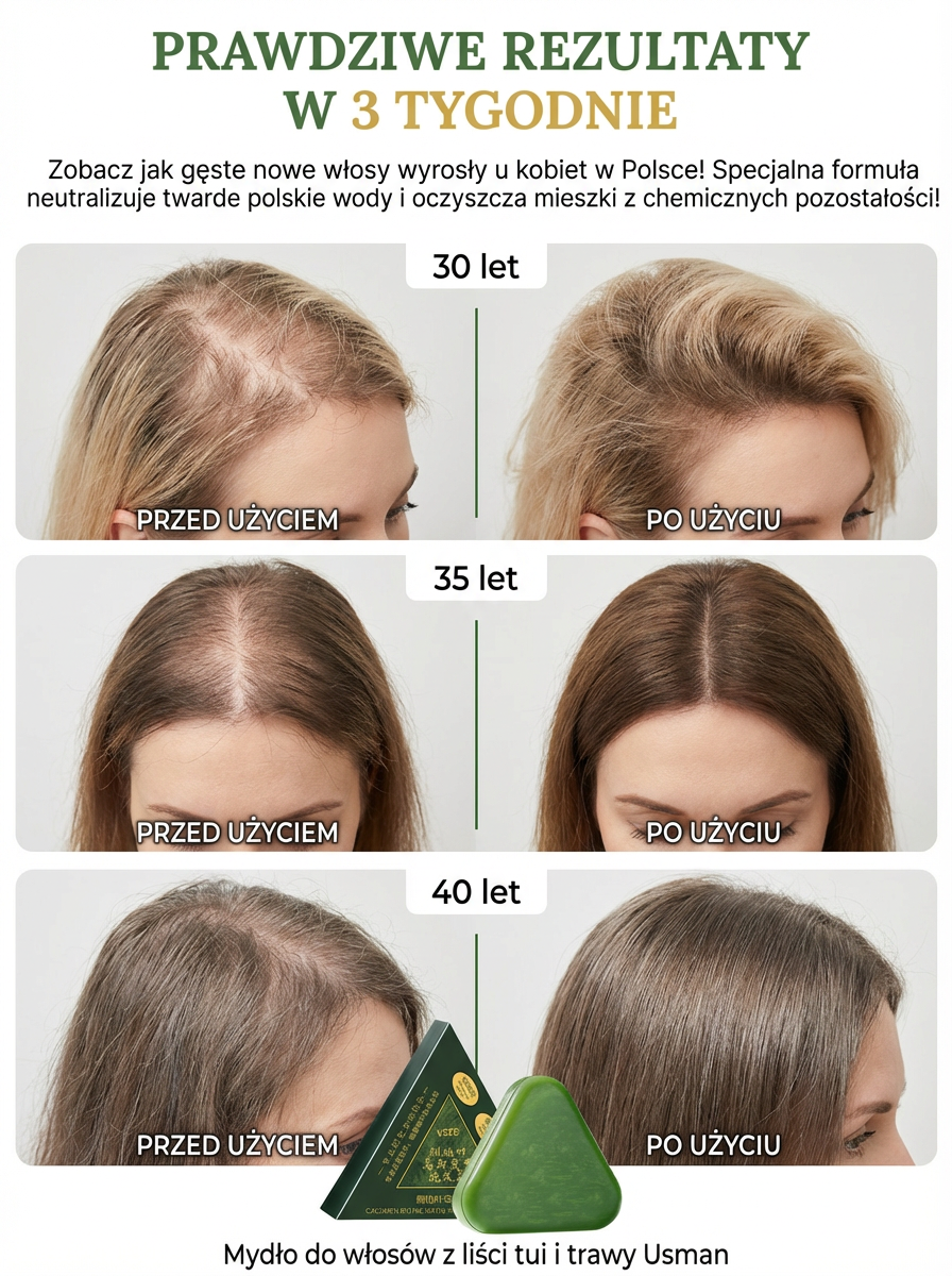 🌿Budzi martwe cebulki, w 7 dni hamuje łysienie, w 30 dni daje gęste nowe włosy!