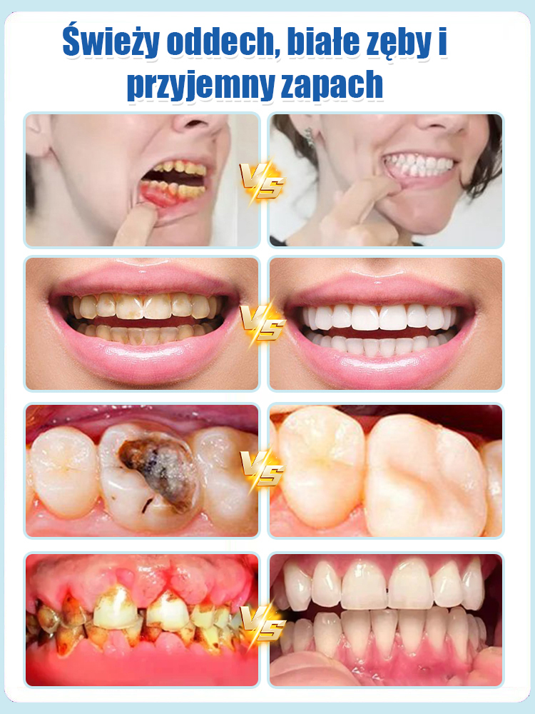 ✨Żegnaj żółte zęby w 7 dni! Probiotyczna pasta do zębów 💖 Pewność uśmiechu podczas robienia zdjęć 😄