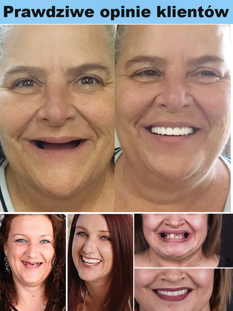 Pewność przy żuciu, już więcej nie martw się o luźne protez! 🦷 Amerykański zestaw do poprawy protez 🔥 Odzyskaj siłę młodzieńczego gryzienia!